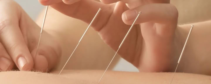 ウブドでの鍼治療1対1セッション